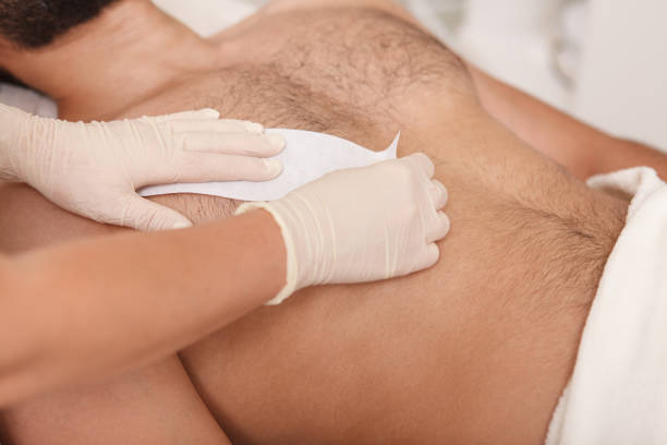 Epilation